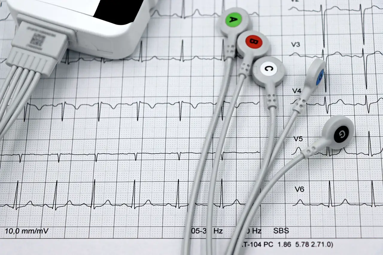 Detailed ECG Leads on Heart Monitor Printout