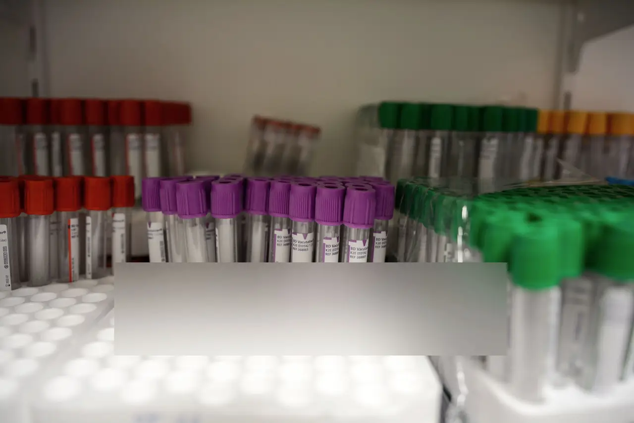 Colorful Blood Collection Tubes in Lab Setting